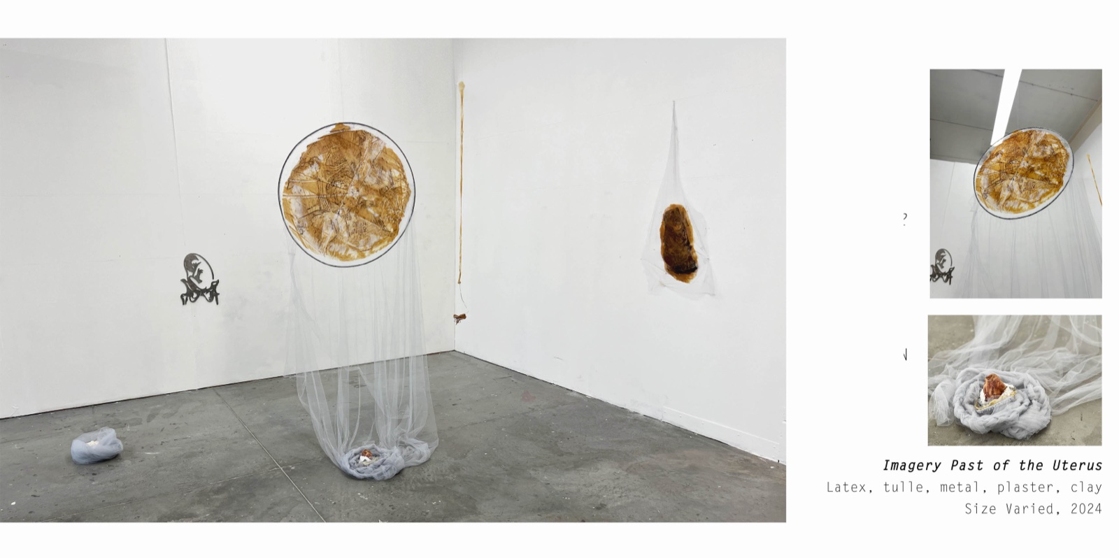 Imagery Past of the Uterus