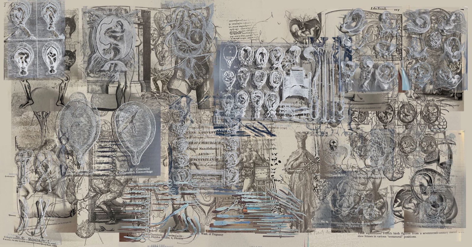 Archive of uterus representations — RCA Research Biennale 2024