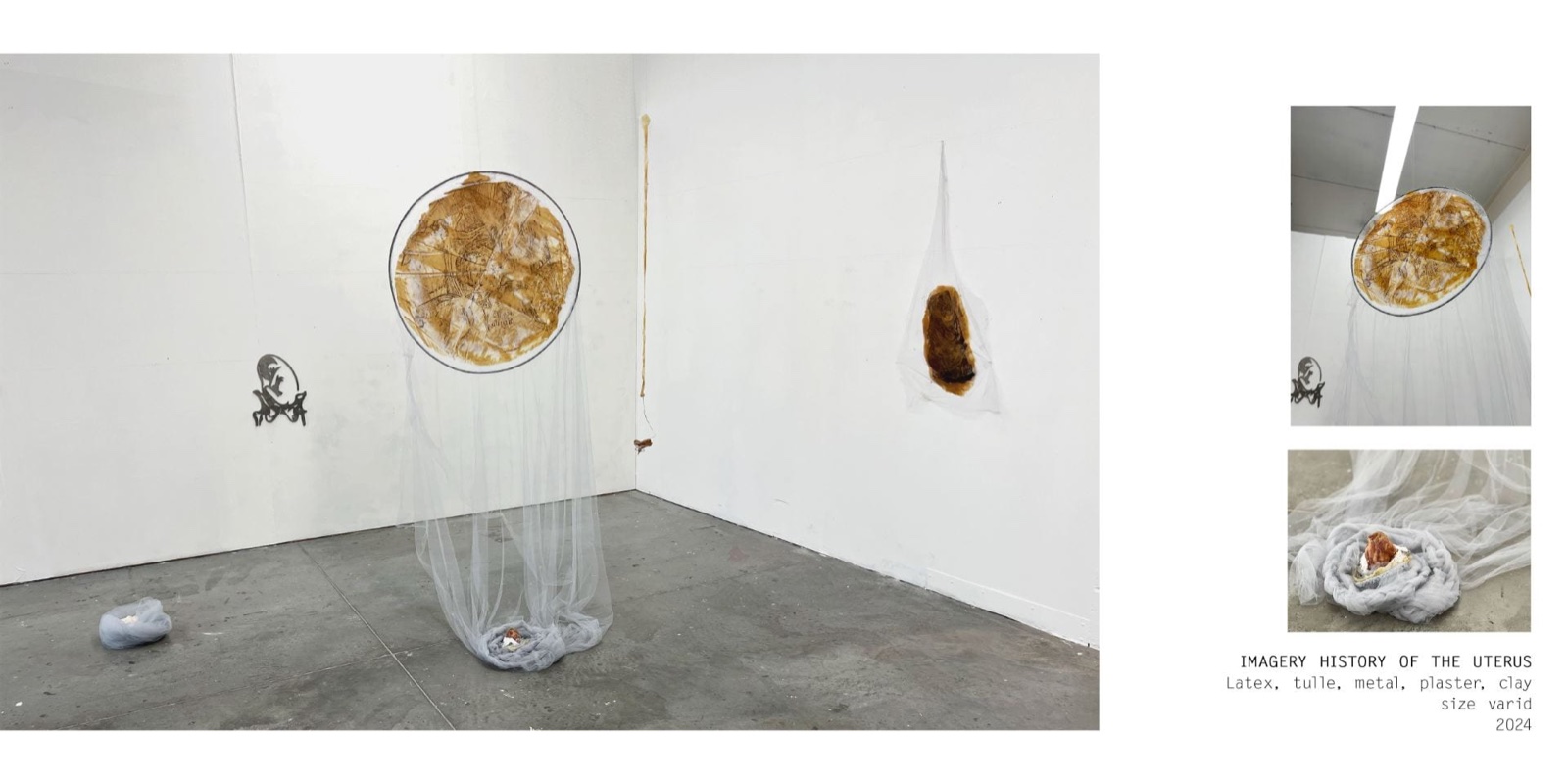 Imagery History of the Uterus